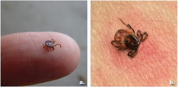 Figure 6. Lone star tick (a) Photo courtesy of Gerald Homes, California Polytechnic State University at San Luis Obispo, Bugwood.org. Tick attached to skin (b)