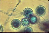 Figure 3. Protective, thick-walled oospore produced by Pythium