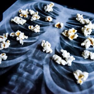 Popcorn Lung - Medical Condition