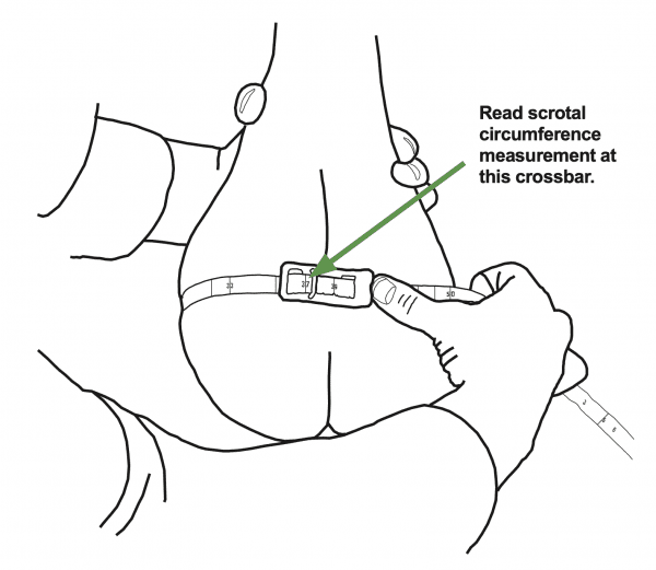 Figure 1. Proper method for measuring scrotal circumference