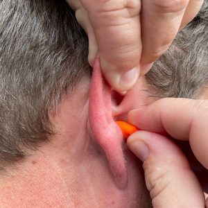 Figure 9. Earplugs are inserted into the ear canal.