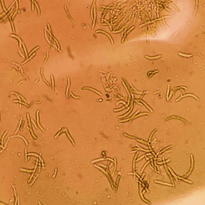 Figure 2d. Reproductive structures showing microscopic banana-shaped septate conidia.