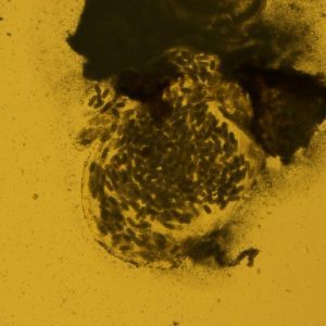 Figure 6. Egg masses emerging from a pierced female at 20X magnification.