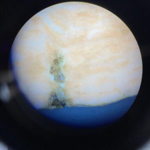 Figure 4. Root-knot nematode females surrounded by necrotic areas in the root tissue at 10X magnification.