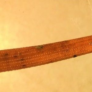 Figure 2B Sporulation of tiny black fungal fruiting bodies (pycnidia) on the infected needles.