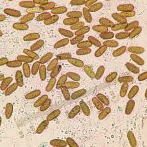 Figure 2C Microscopic ovoid-shaped aseptate conidia.