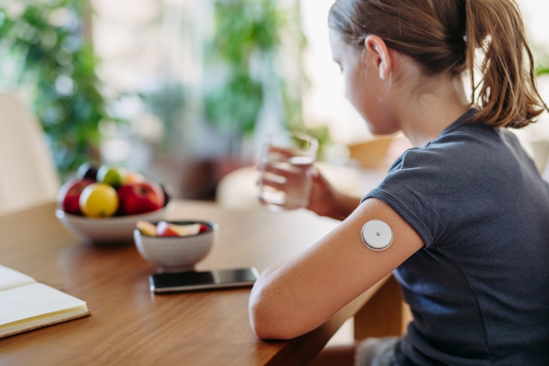 An over the should shot of a girl with an insulin pump on her arm drinking a glass of water. She's sitting at a table, where there is also a book, bowl of fruit and smartphone.