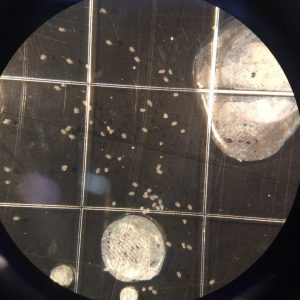 Figure 3. Glochidia under microscope (Photo credit: Brittany Barker-Jones)