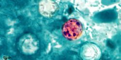 Cyclospora cayetanensis