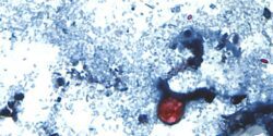 Cyclospora cayetanensis oocysts