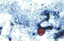 Cyclospora cayetanensis oocysts