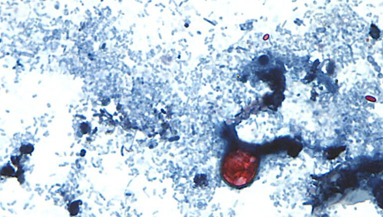 Cyclospora cayetanensis oocysts